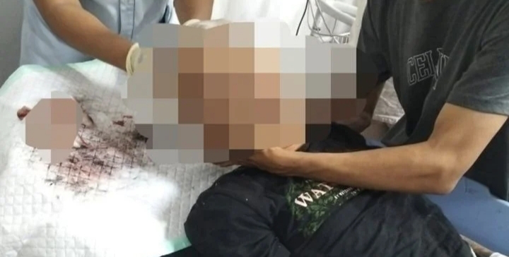 Korban diduga pengeroyokan Gengster saat penanganan Medis (Foto: Ist)